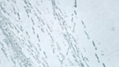 mobile call tracking analysis